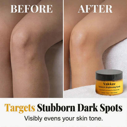 🏆 LIMITED-TIME 60% OFF! ✨Turmeric Exfoliating Body Scrub