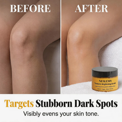 🏆 LIMITED-TIME 60% OFF! ✨Turmeric Exfoliating Body Scrub