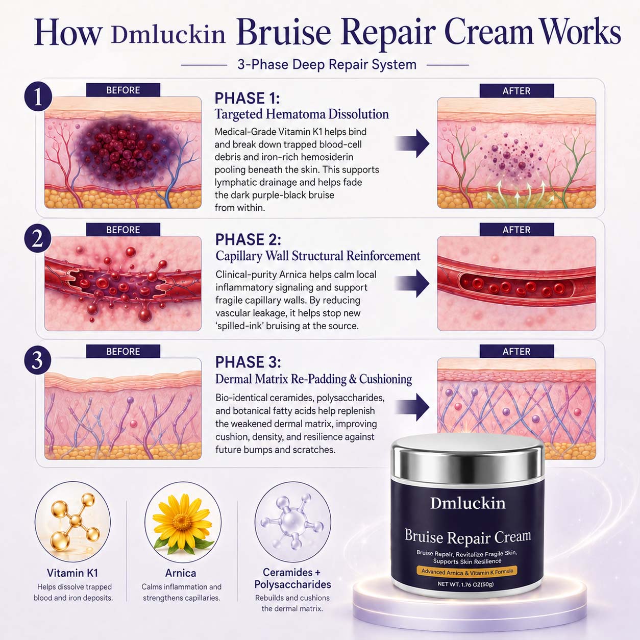 💥100K+ SOLD💕- Dmluckin™ Bruise Repair & Skin-Strengthening Cream