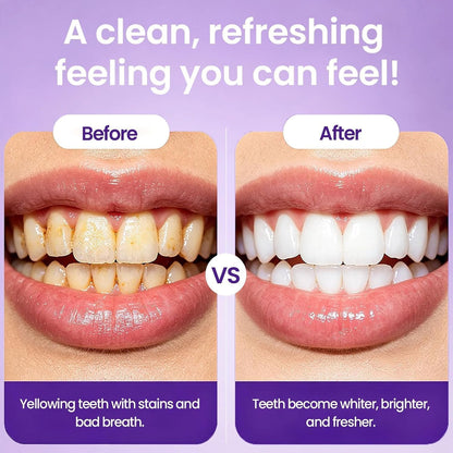 AQA®Teeth Color Correcting Tablets